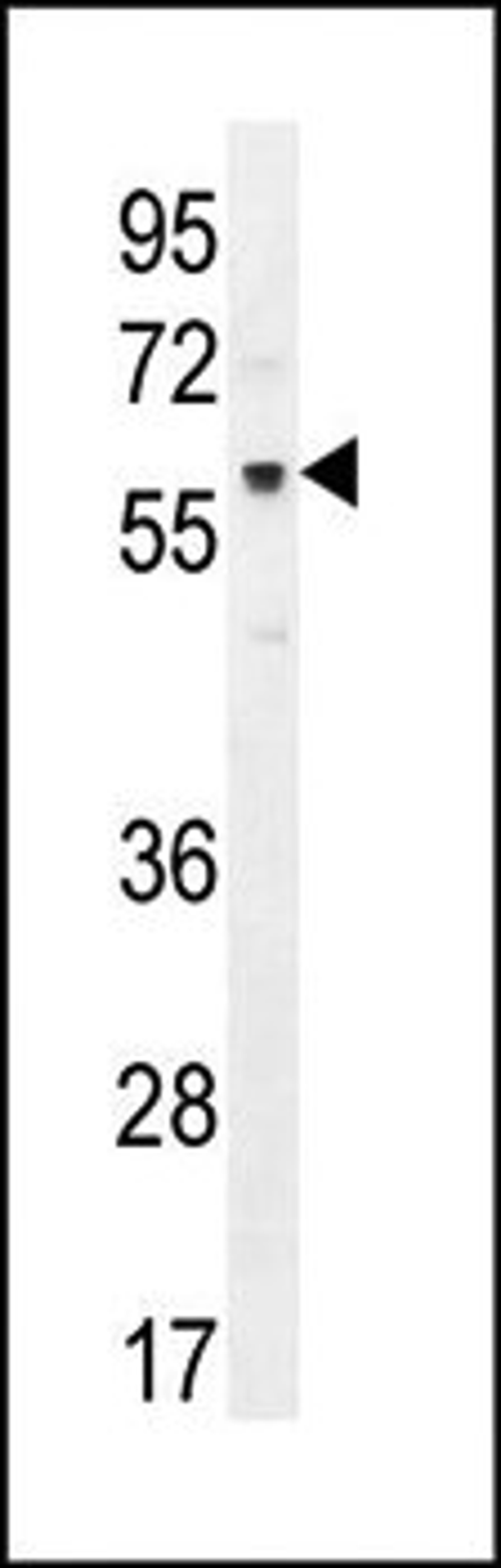 Western blot analysis of MCF-7 cell line lysates (35ug/lane) using AKT1 antibody (C-term T450)