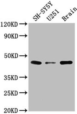 Western Blot. Positive WB detected in: SH-SY5Y whole cell lysate, U251 whole cell lysate, Rat brain tissue. All lanes: LRTM2 antibody at 1:2000. Secondary. Goat polyclonal to rabbit IgG at 1/50000 dilution. Predicted band size: 42 kDa. Observed band size: 42 kDa