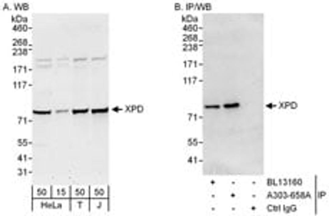 Detection of human XPD by western blot and immunoprecipitation.