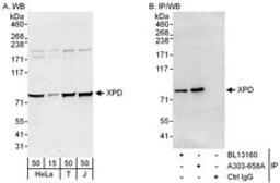 Detection of human XPD by western blot and immunoprecipitation.