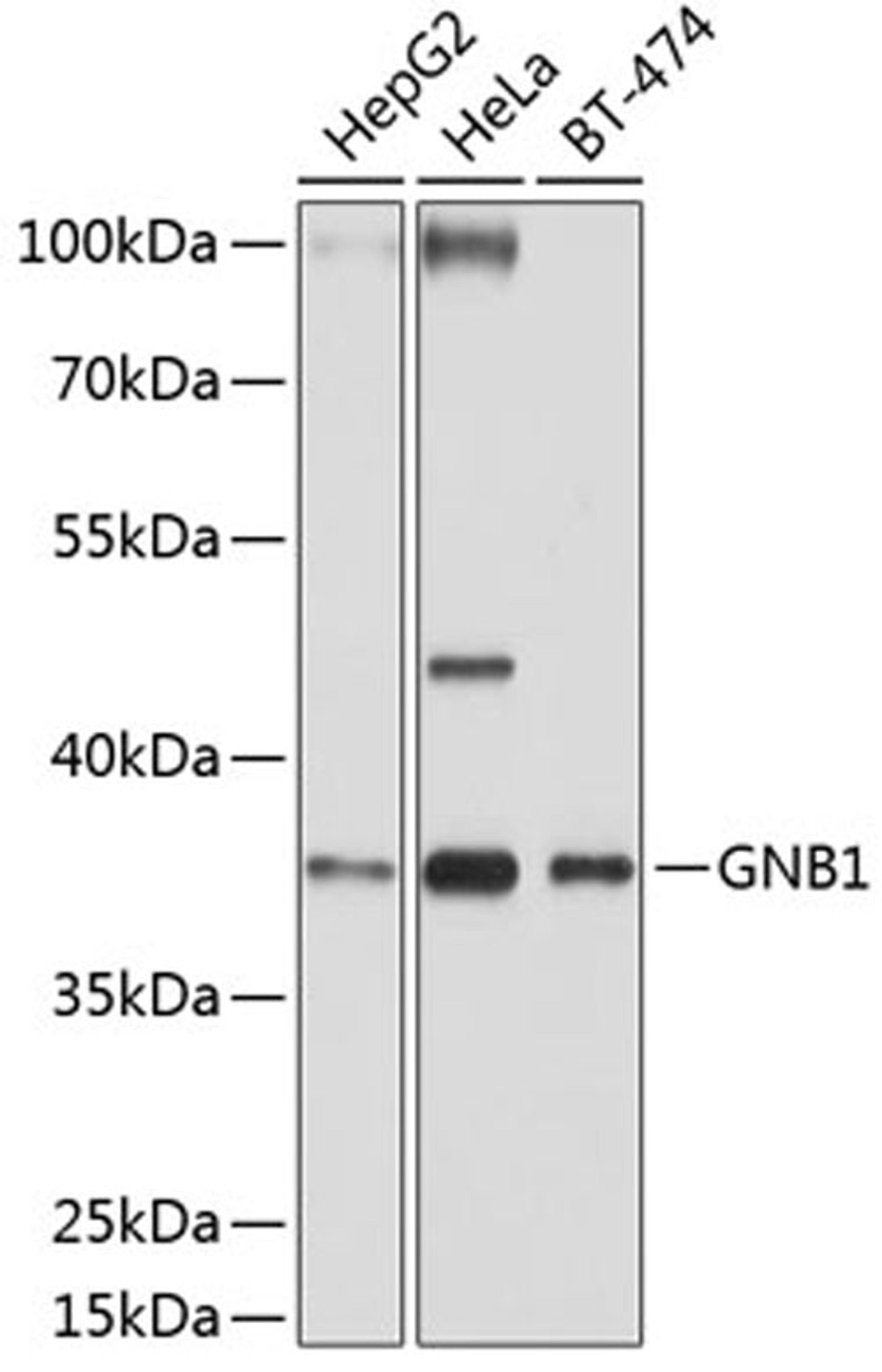 Western blot - GNB1 antibody (A1867)