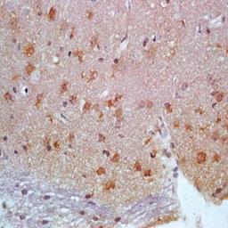 Immunohistochemical analysis of formalin-fixed and paraffin embedded rat brain tissue (dilution at:1:200) using Calbindin antibody