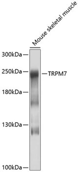 Western blot - TRPM7 antibody (A10075)