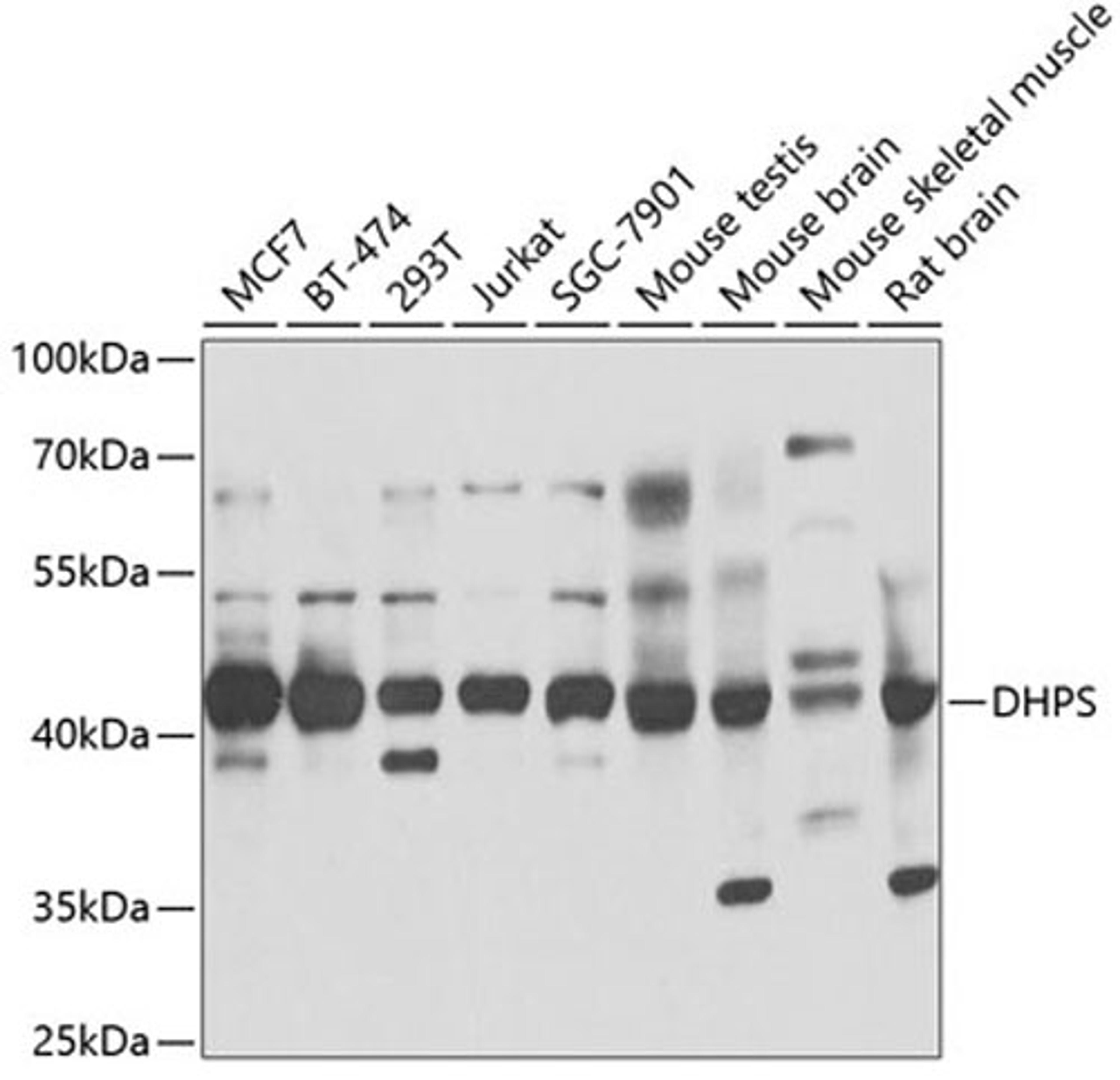 Western blot - DHPS antibody (A6367)