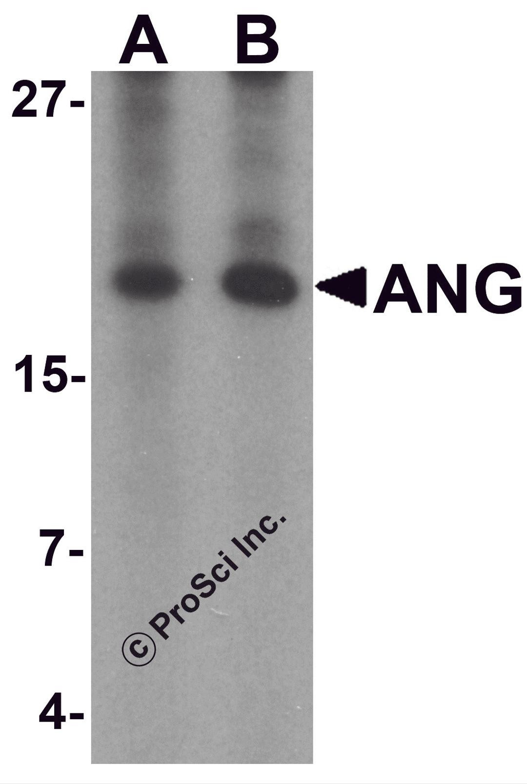 Western blot analysis of ANG in rat liver tissue lysate with Ang antibody at (A) 1 and (B) 2 &#956;g/mL.