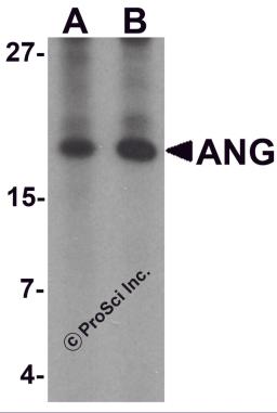 Western blot analysis of ANG in rat liver tissue lysate with Ang antibody at (A) 1 and (B) 2 &#956;g/mL.