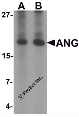 Western blot analysis of ANG in rat liver tissue lysate with Ang antibody at (A) 1 and (B) 2 μg/mL.