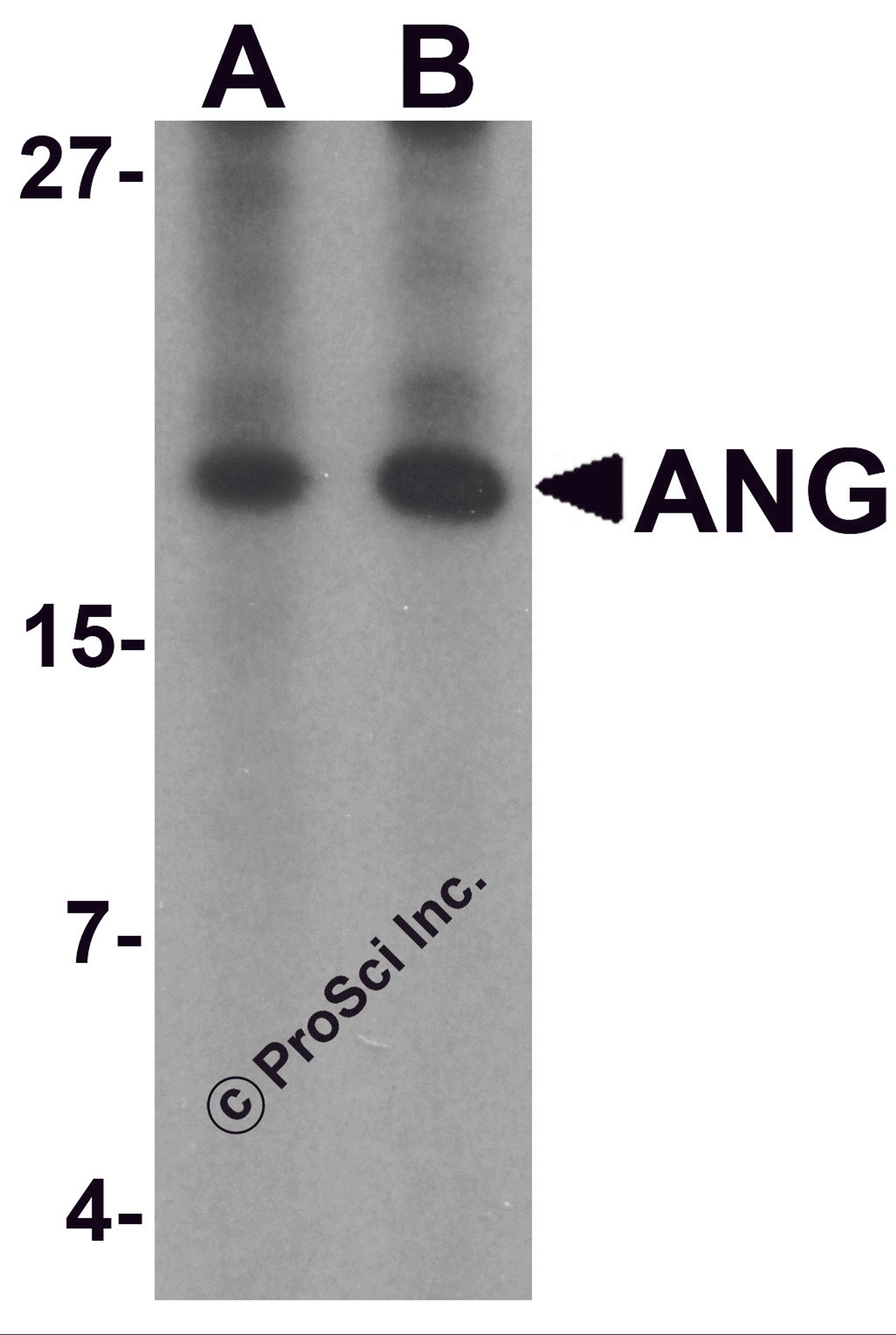 Western blot analysis of ANG in rat liver tissue lysate with Ang antibody at (A) 1 and (B) 2 μg/mL.