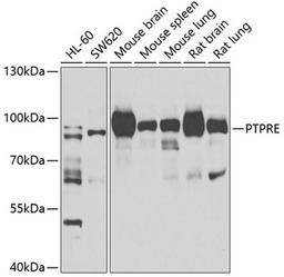 Western blot - PTPRE antibody (A7209)