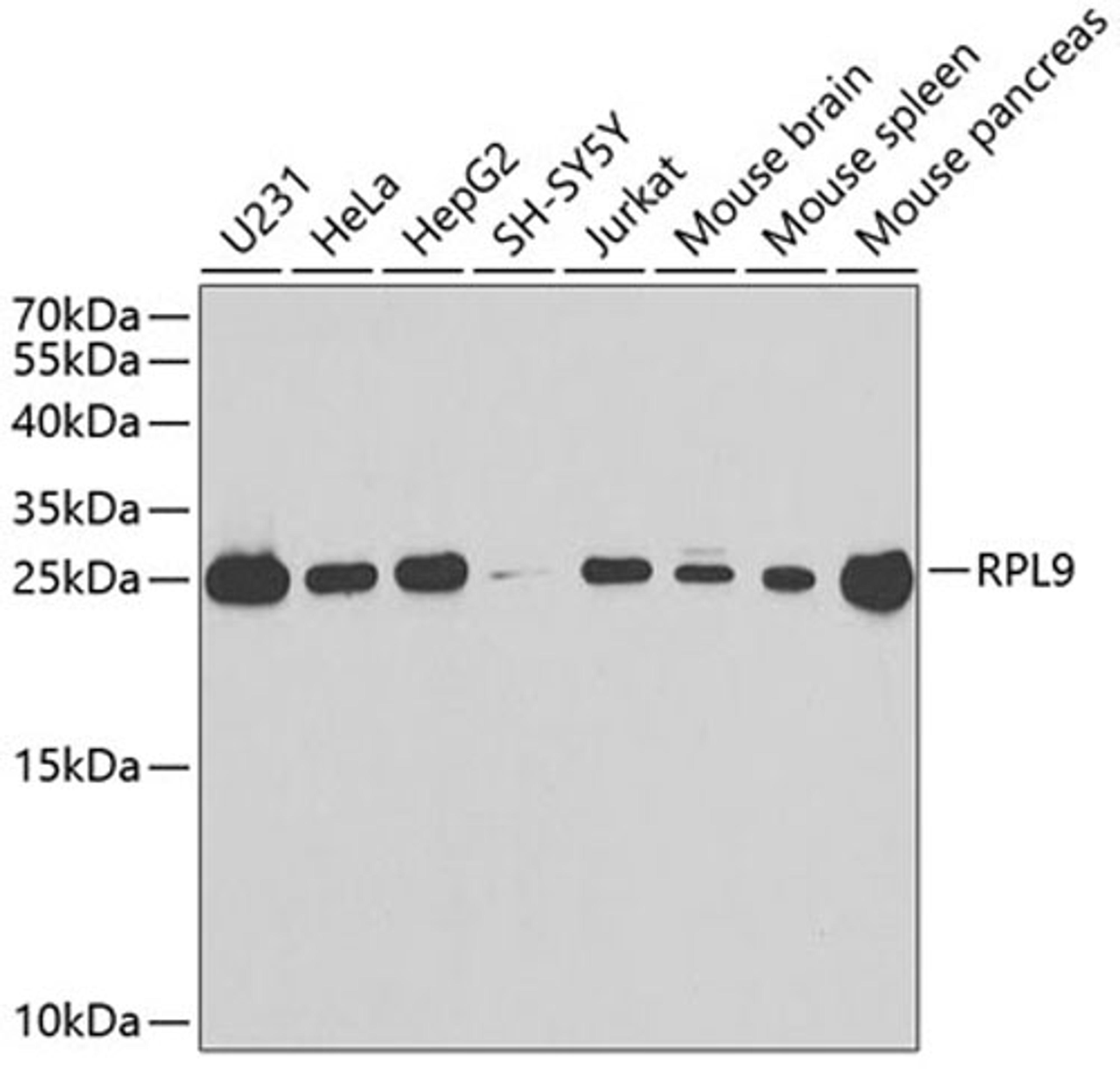 Western blot - RPL9 antibody (A13632)