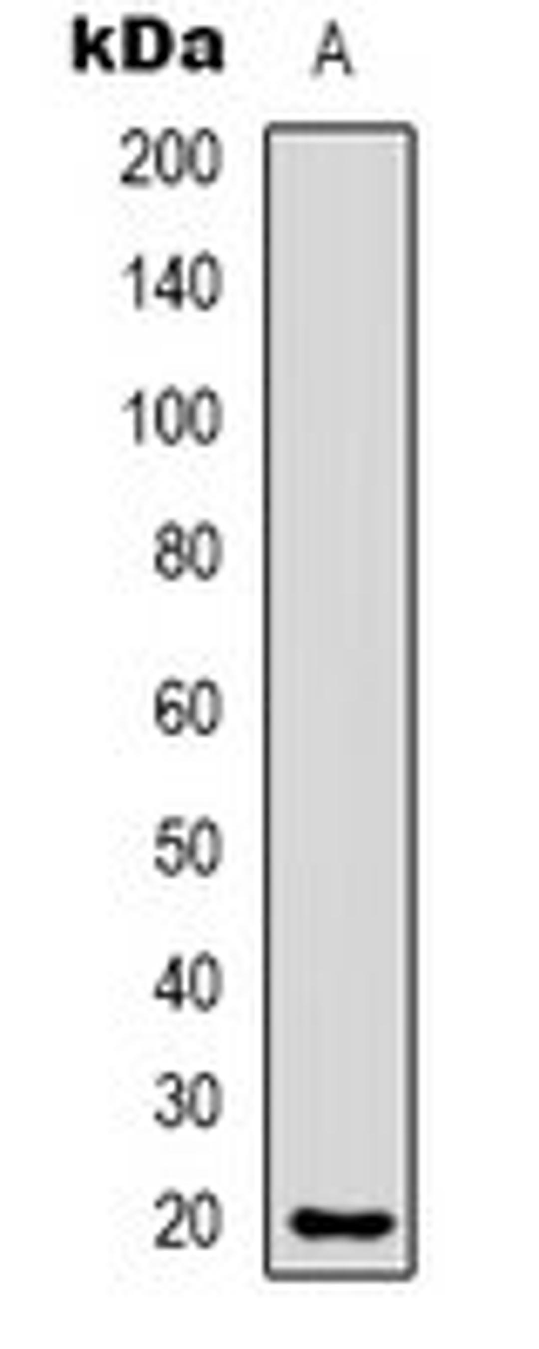 Western blot analysis of Hela (Lane 1) whole cell lysates using CMTM8 antibody