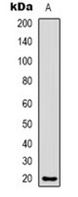 Western blot analysis of Hela (Lane 1) whole cell lysates using CMTM8 antibody