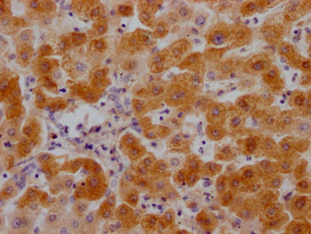 IHC image of CSB-RA699863A0HU diluted at 1:100 and staining in paraffin-embedded human liver tissue performed on a Leica BondTM system. After dewaxing and hydration, antigen retrieval was mediated by high pressure in a citrate buffer (pH 6.0). Section was blocked with 10% normal goat serum 30min at RT. Then primary antibody (1% BSA) was incubated at 4℃ overnight. The primary is detected by a Goat anti-rabbit IgG polymer labeled by HRP and visualized using 0.05% DAB.
