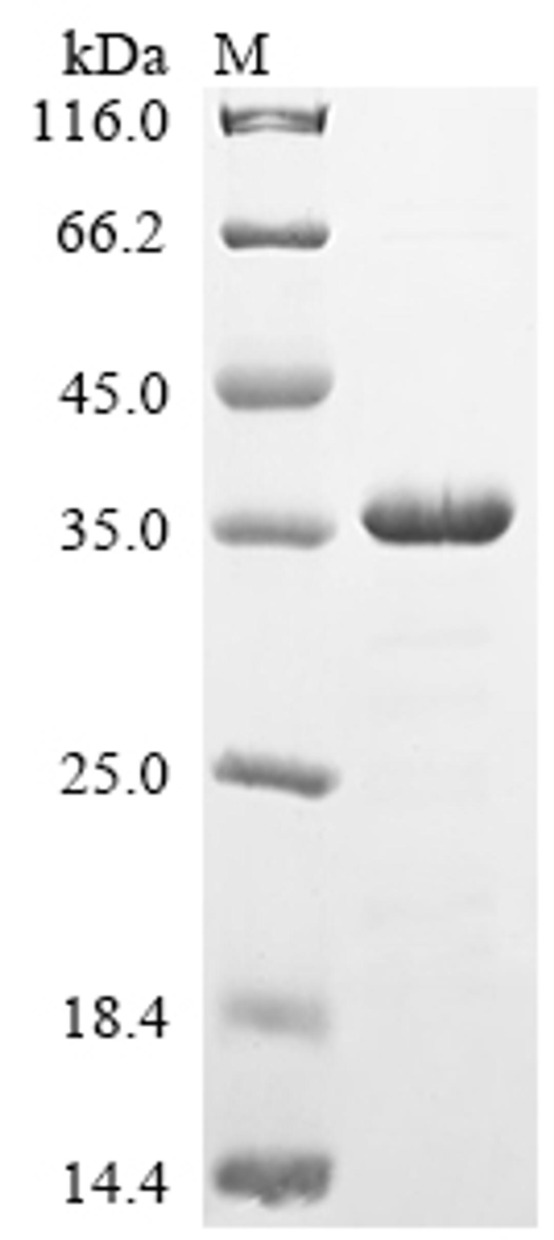 (Tris-Glycine gel) Discontinuous SDS-PAGE (reduced) with 5% enrichment gel and 15% separation gel.