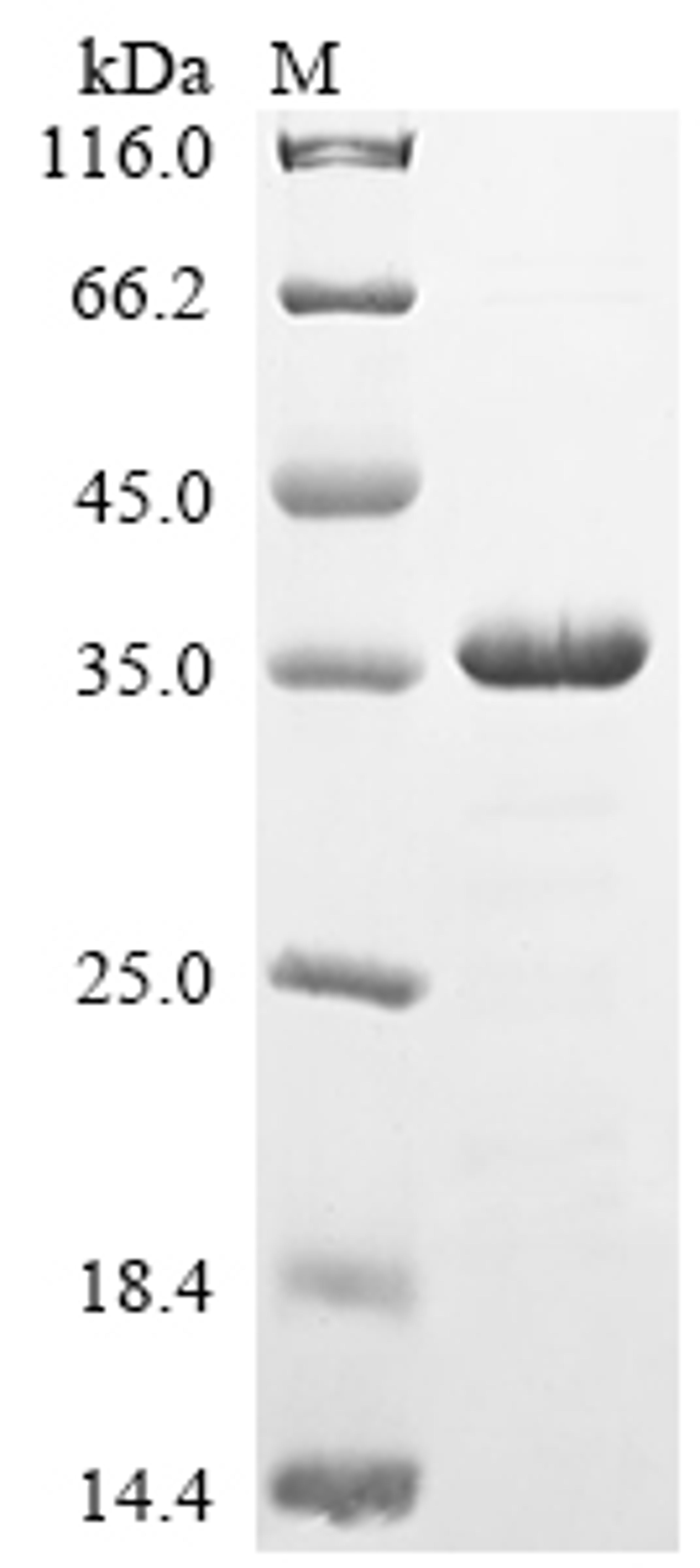 (Tris-Glycine gel) Discontinuous SDS-PAGE (reduced) with 5% enrichment gel and 15% separation gel.