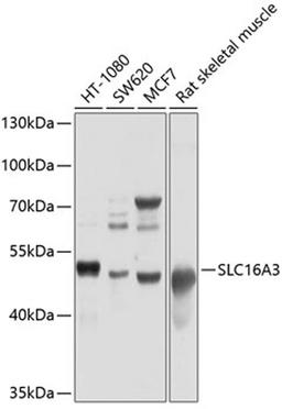 Western blot - MCT4/SLC16A3 antibody (A10548)