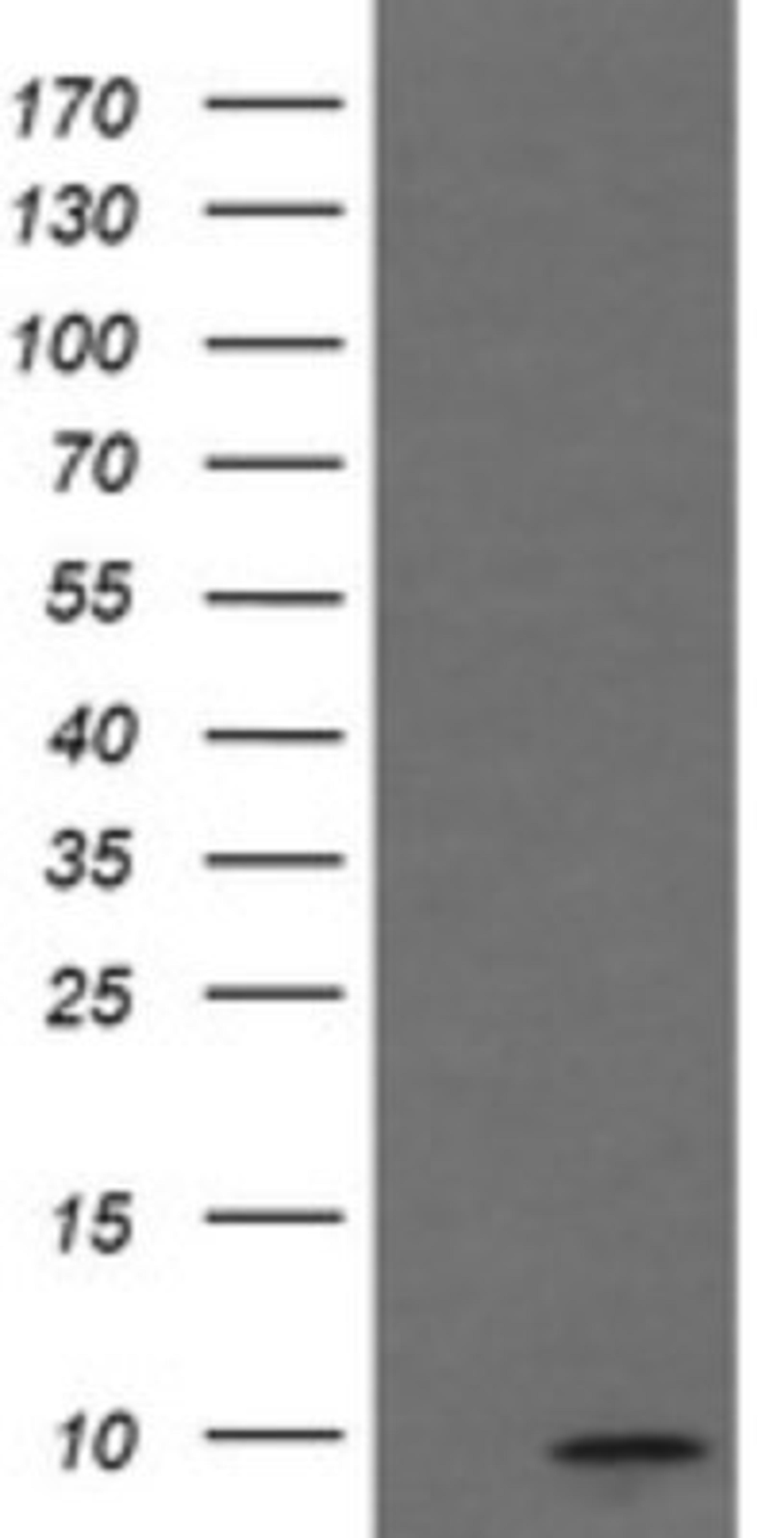 Western Blot: MINOS1 Antibody (4H7) [NBP2-45550] - Analysis of HEK293T cells were transfected with the pCMV6-ENTRY control (Left lane) or pCMV6-ENTRY MINOS1.