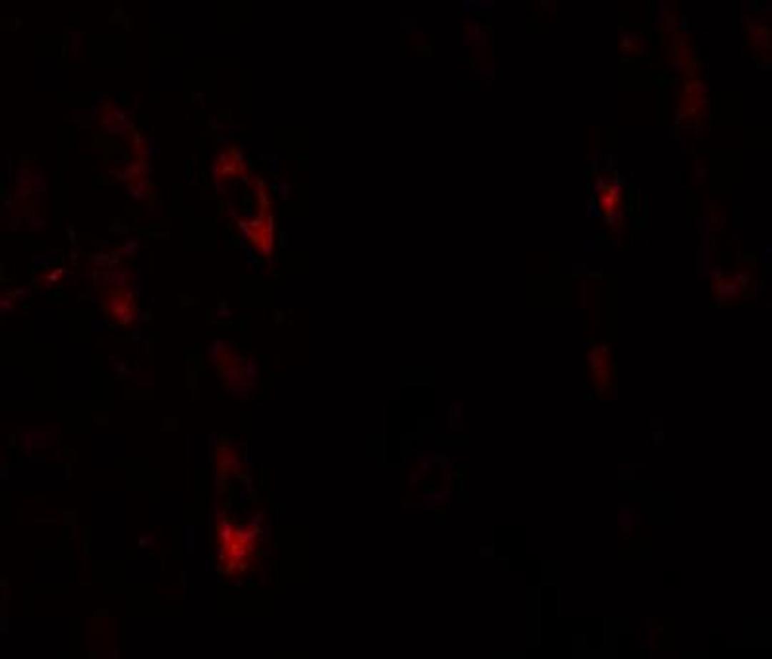 Immunocytochemistry/Immunofluorescence: LRRTM1 Antibody [NBP1-76528] - Immunofluorescence of LRRTM1 in human brain tissue with LRRTM1 antibody at 20 ug/mL.