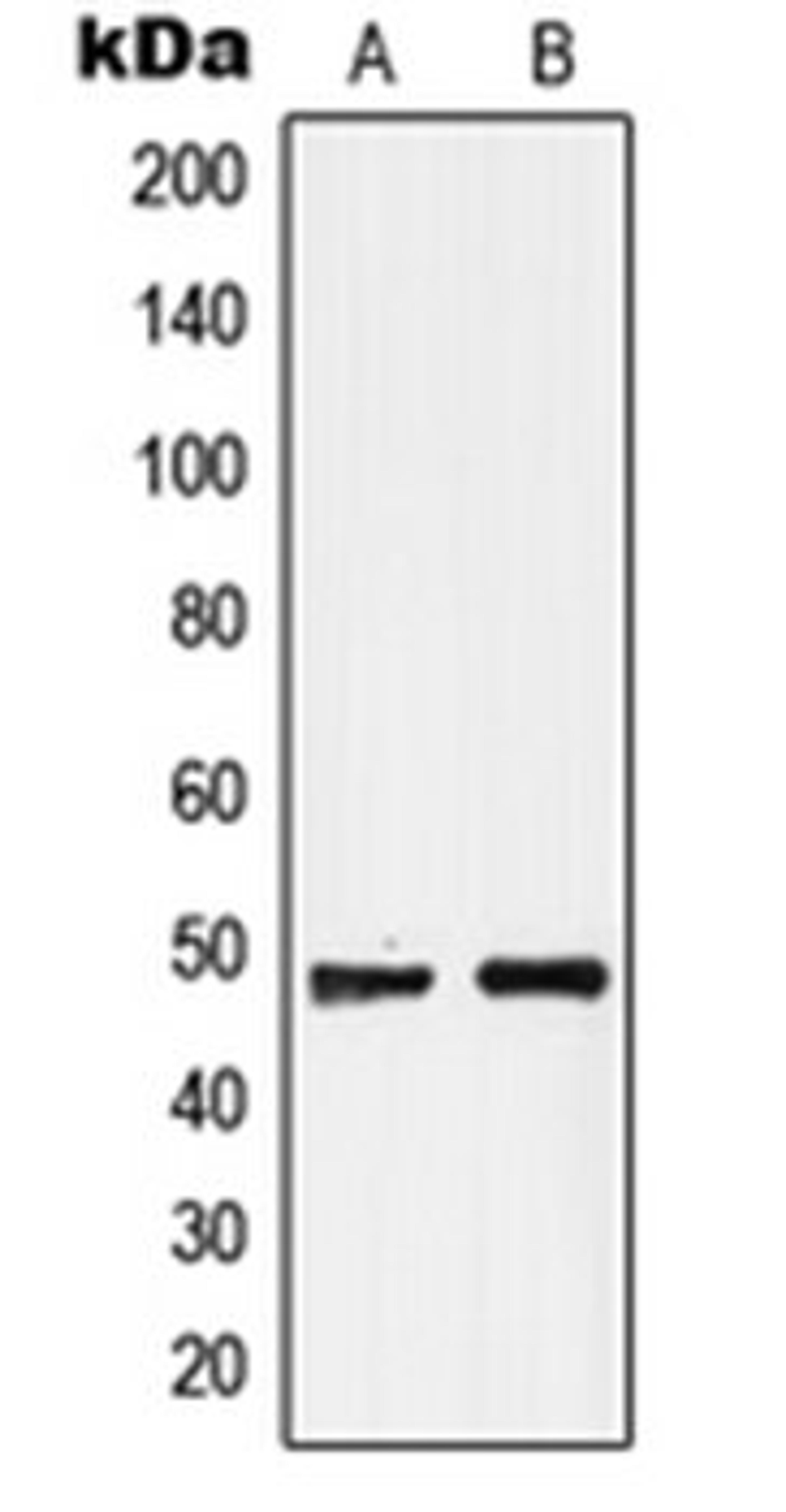 Western blot analysis of MCF7 (Lane 1), Raji (Lane 2) whole cell lysates using GPR19 antibody