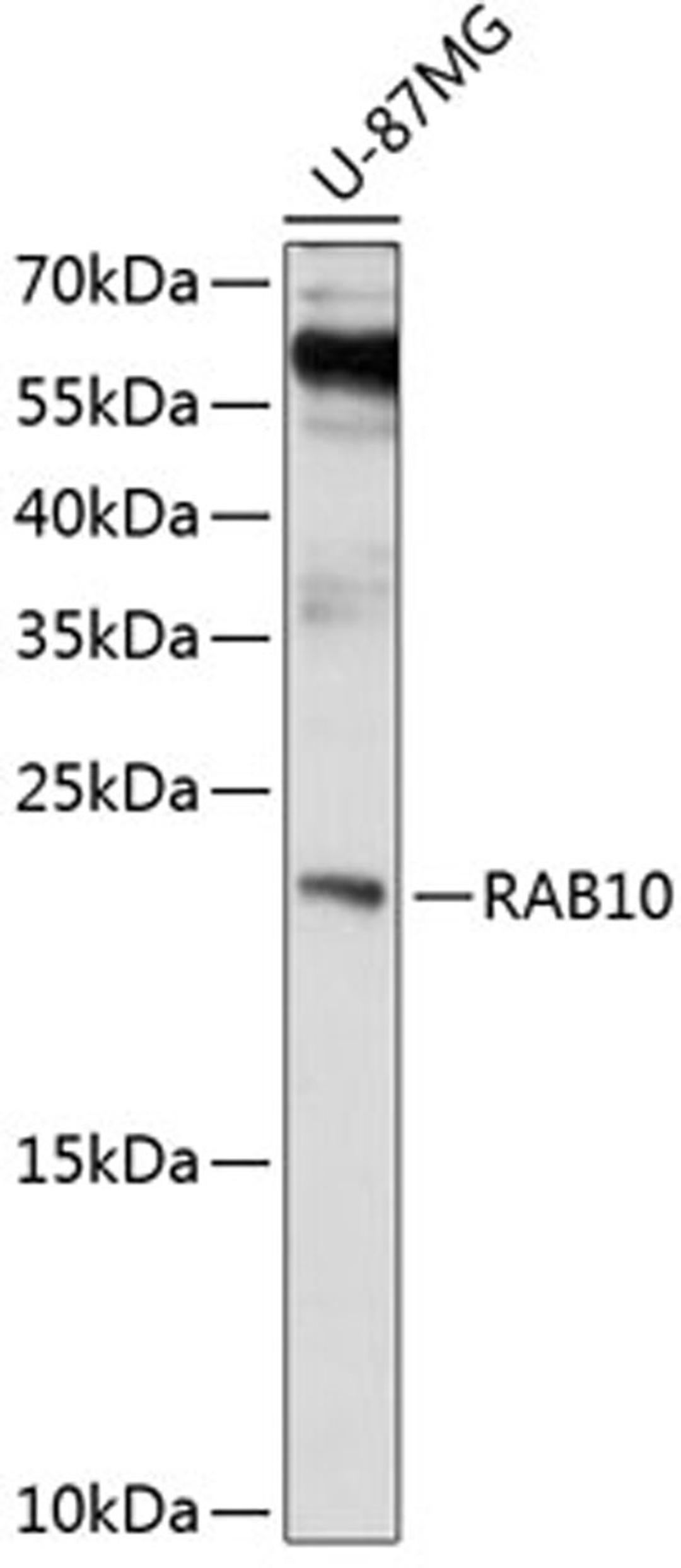 Western blot - RAB10 antibody (A4459)