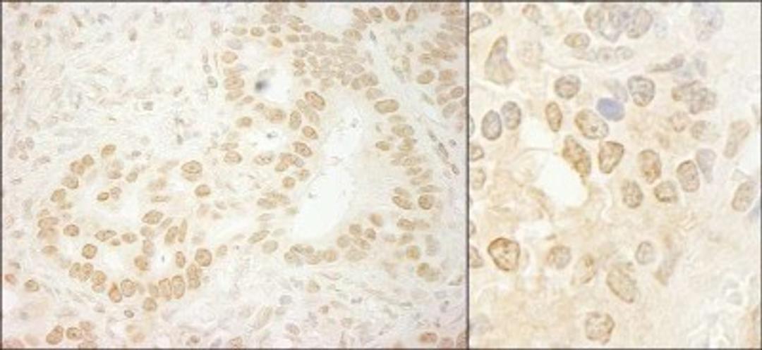 Immunohistochemistry-Paraffin: LEO1 Antibody [NB600-276] - Human stomach carcinoma (left) and mouse teratoma (right).  Antibody used at a dilution of 1:5,000.