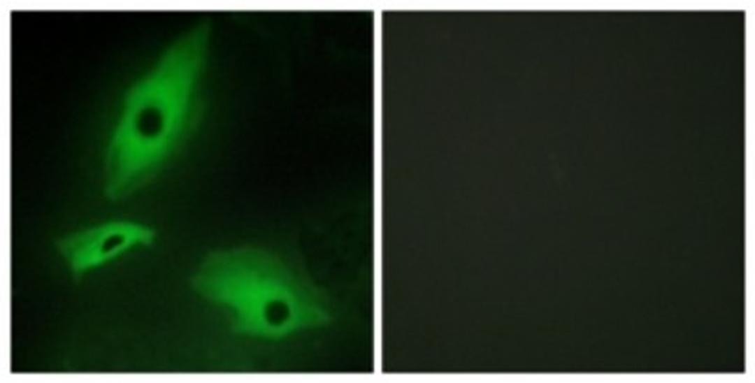 Immunocytochemistry/Immunofluorescence: LTBR Antibody [NBP1-67921] - Analysis of HeLa cells, using LTBR Antibody. The picture on the right is treated with the synthesized peptide.