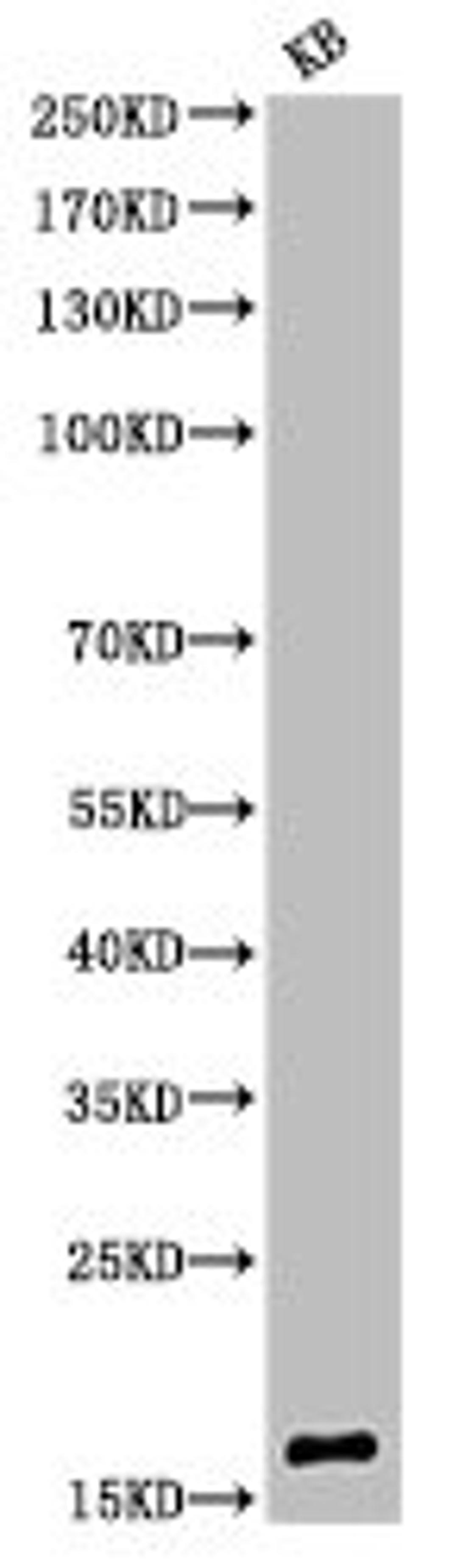 Western Blot analysis of KB cells using Acetyl-Histone H3 (K9) Polyclonal Antibody