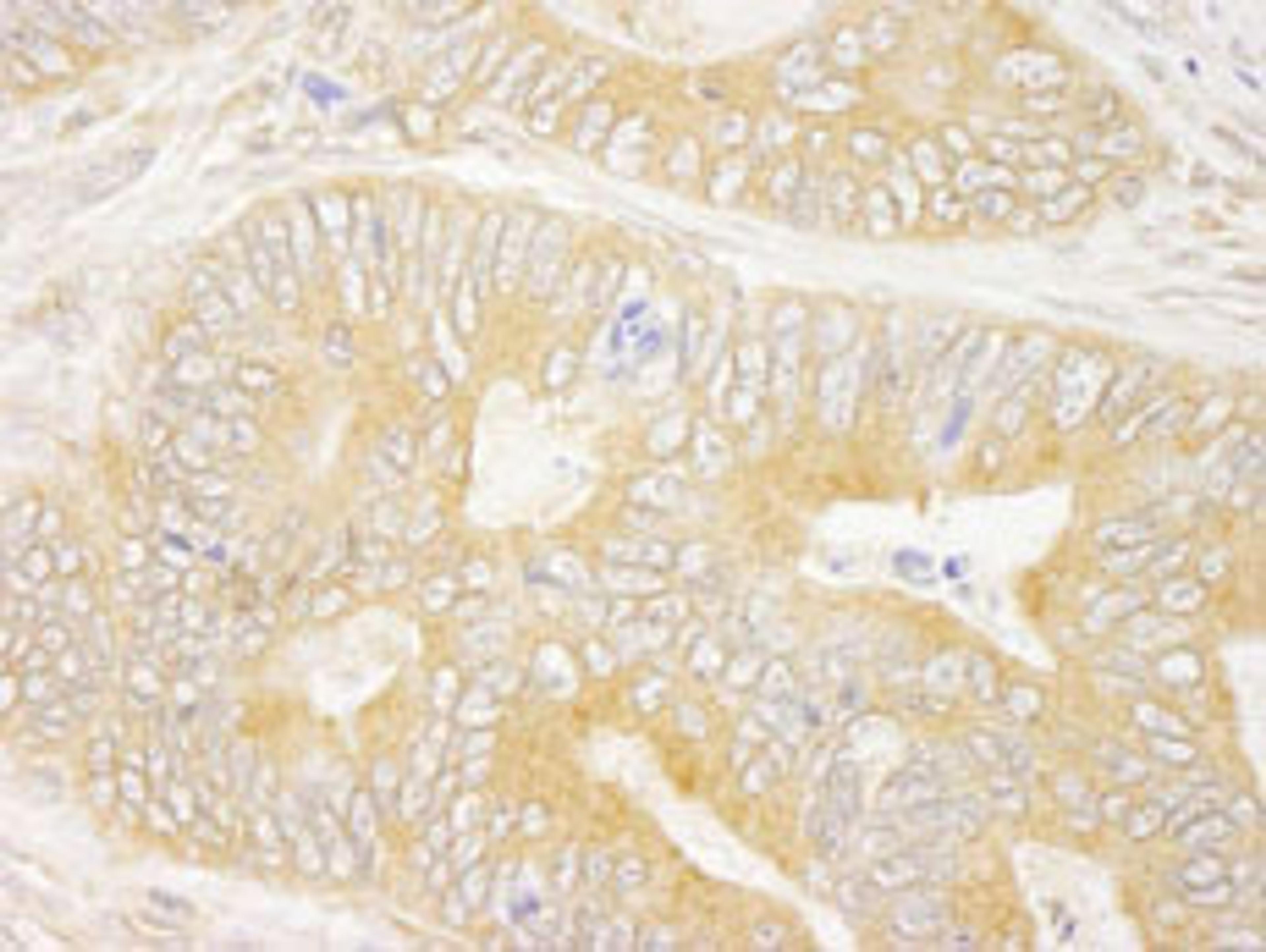 Detection of human GRB10 by immunohistochemistry.