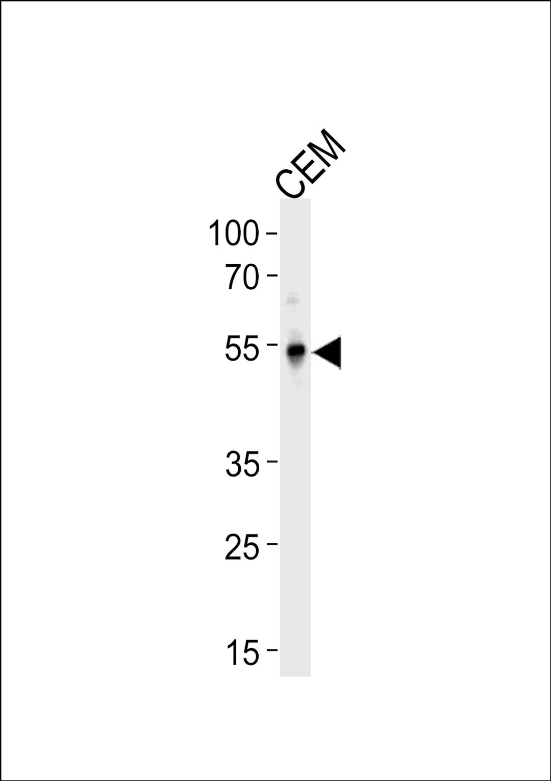 Western blot analysis in CEM cell line lysates (35ug/lane).