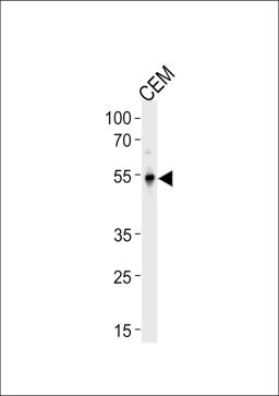 Western blot analysis in CEM cell line lysates (35ug/lane).