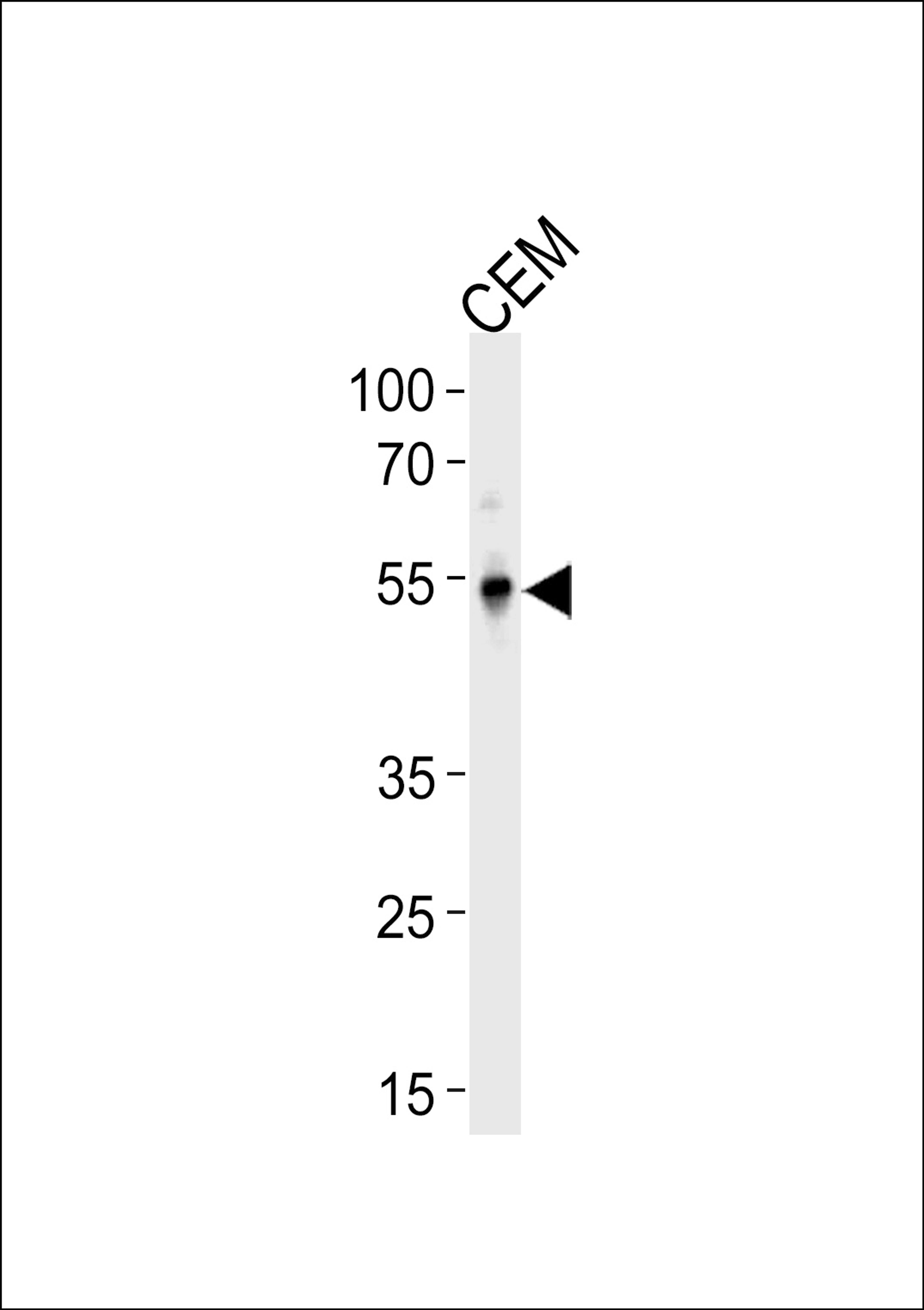 Western blot analysis in CEM cell line lysates (35ug/lane).