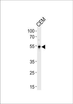 Western blot analysis in CEM cell line lysates (35ug/lane).