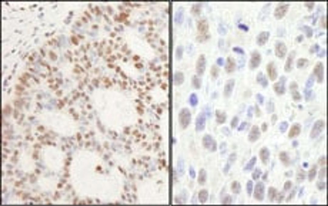 Detection of human and mouse PPM1G by immunohistochemistry.