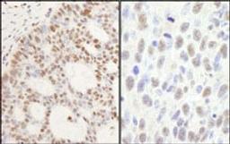 Detection of human and mouse PPM1G by immunohistochemistry.