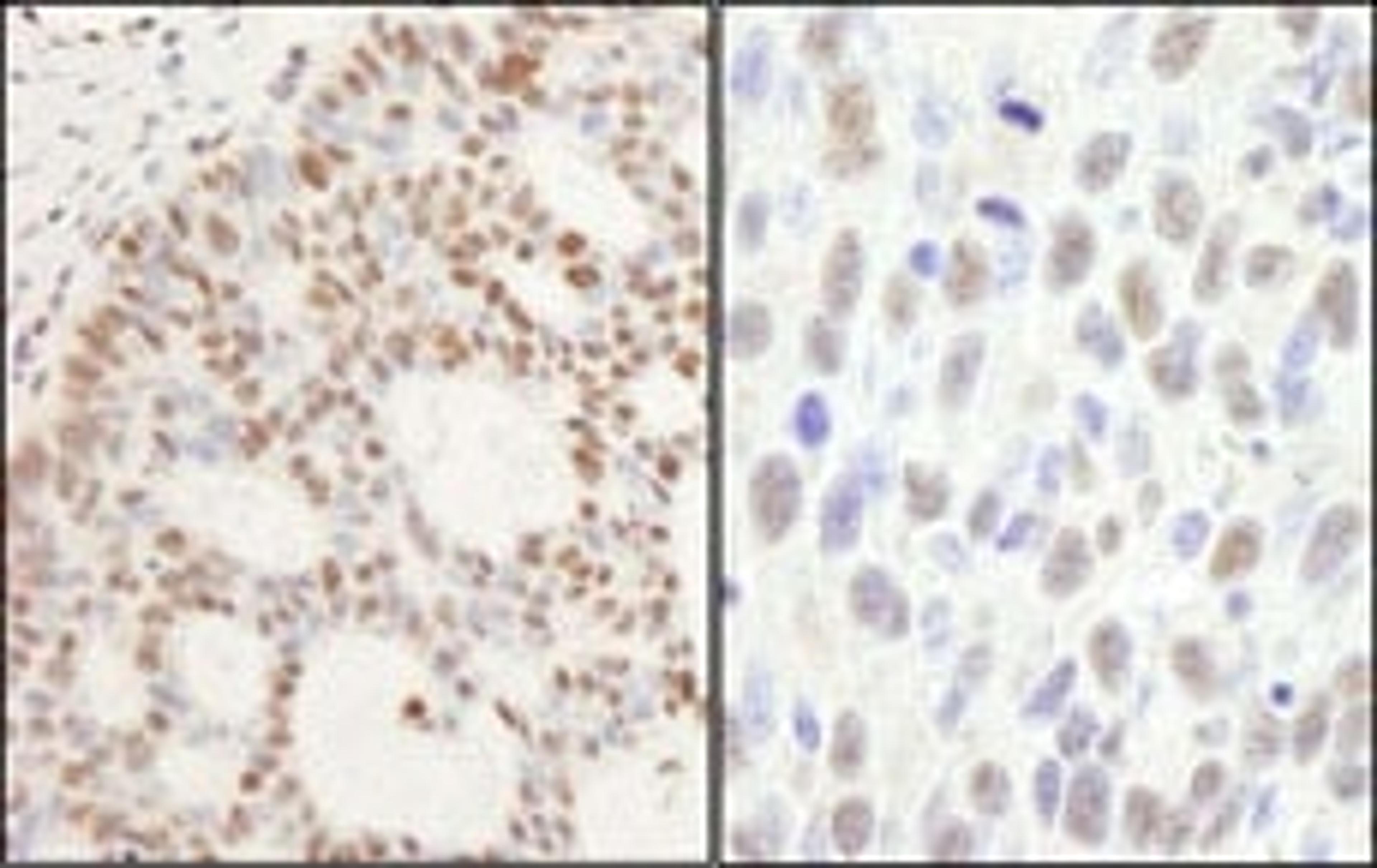 Detection of human and mouse PPM1G by immunohistochemistry.