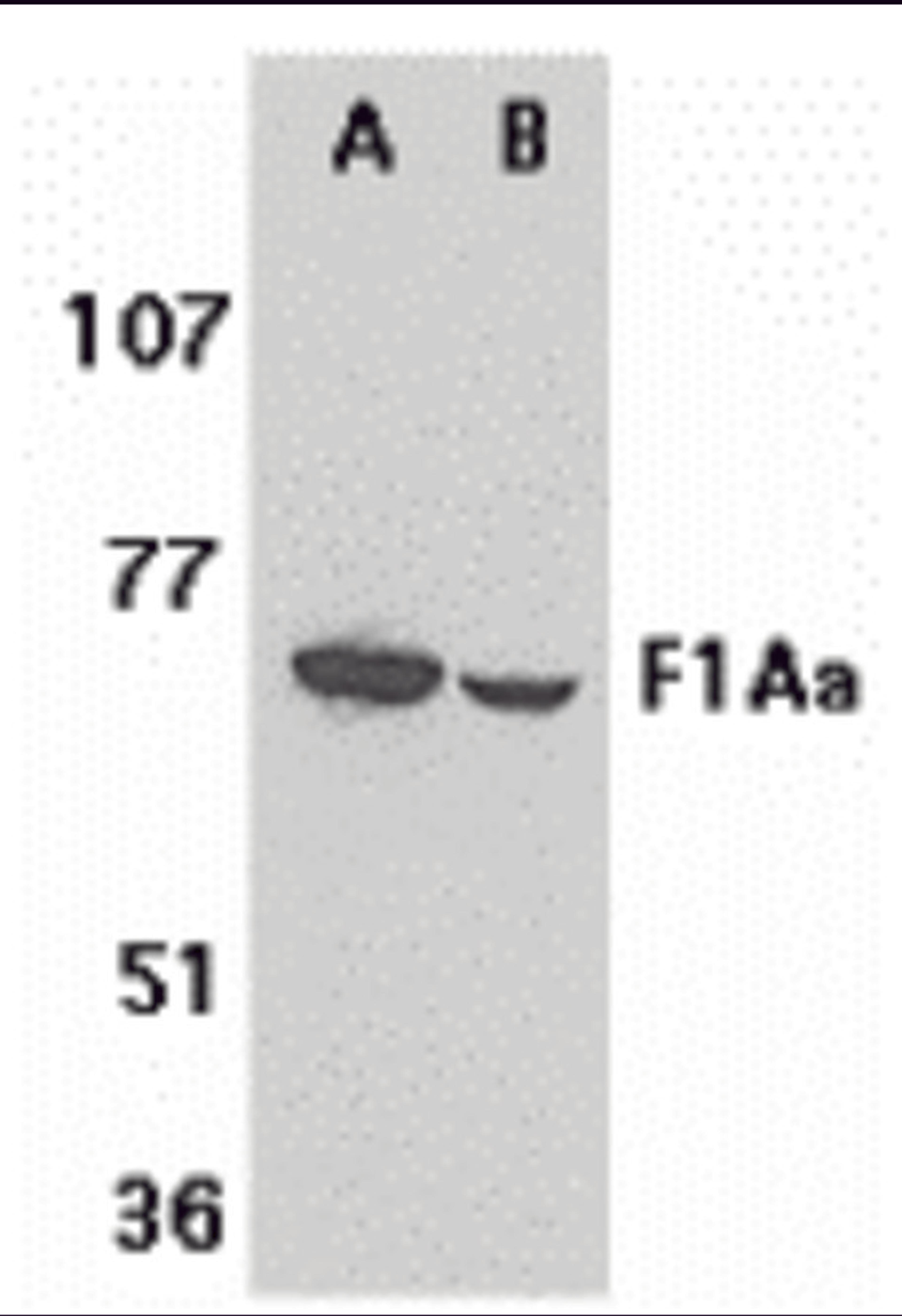 Western blot analysis of F1A alpha in mouse (A) and rat (B) liver tissue lysates with F1A alpha antibody at 1 μg/mL.