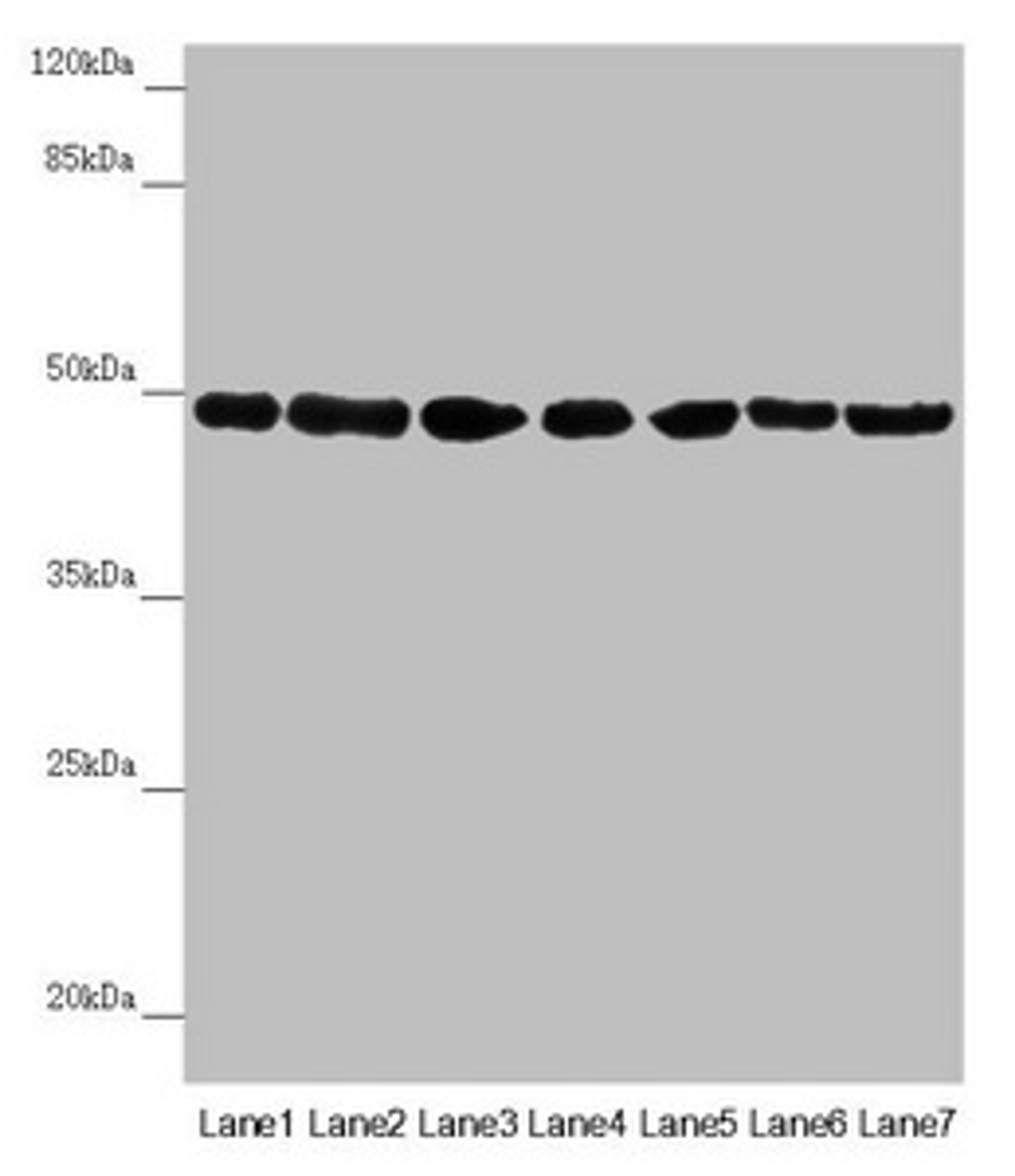 Western blot. All lanes: UQCRC2 antibody at 2.95µg/ml. Lane 1: Human placenta tissue. Lane 2: Mouse large intestine tissue. Lane 3: Mouse small intestine tissue. Lane 4: Mouse brain tissue. Lane 5: HepG2 whole cell lysate. Lane 6: Jurkat whole cell lysate. Lane 7: 293T whole cell lysate. Secondary. Goat polyclonal to rabbit IgG at 1/10000 dilution. Predicted band size: 48 kDa. Observed band size: 48 kDa
