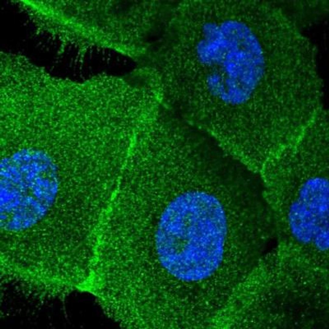 Immunofluorescence: PHACTR4 Antibody [NBP1-82267] - Staining of human cell line A-431 shows positivity in plasma membrane, cytoplasm, cytoskeleton (intermediate filaments) & cell junctions.