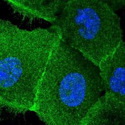 Immunofluorescence: PHACTR4 Antibody [NBP1-82267] - Staining of human cell line A-431 shows positivity in plasma membrane, cytoplasm, cytoskeleton (intermediate filaments) & cell junctions.