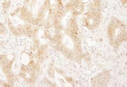 Detection of human Paxillin by immunohistochemistry.