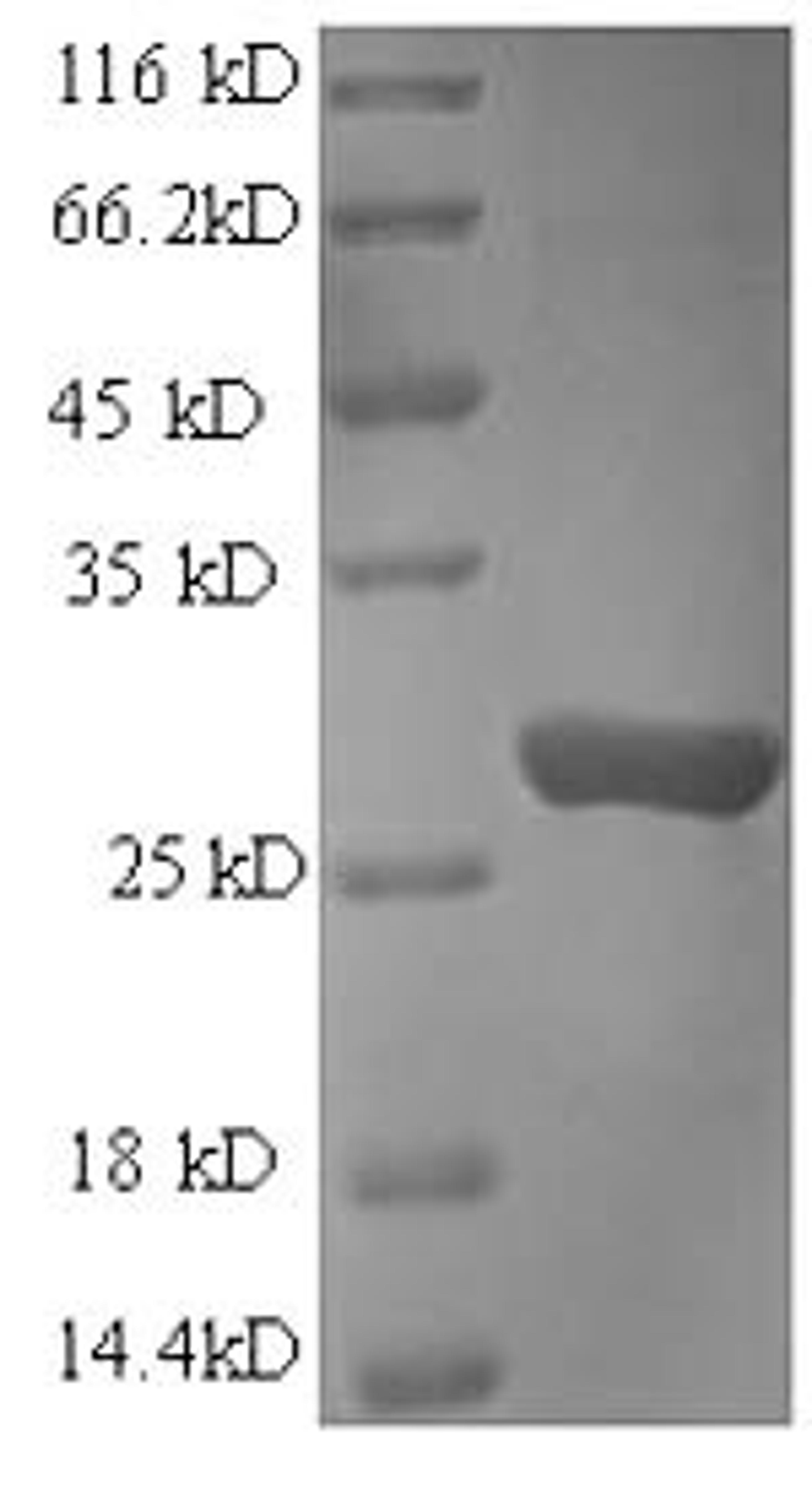 (Tris-Glycine gel) Discontinuous SDS-PAGE (reduced) with 5% enrichment gel and 15% separation gel.
