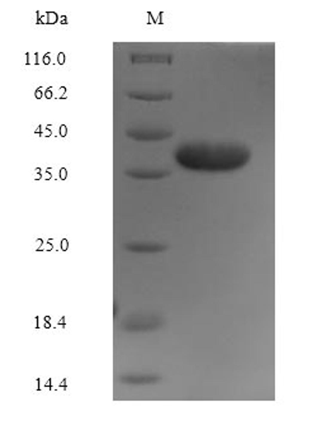 (Tris-Glycine gel) Discontinuous SDS-PAGE (reduced) with 5% enrichment gel and 15% separation gel.