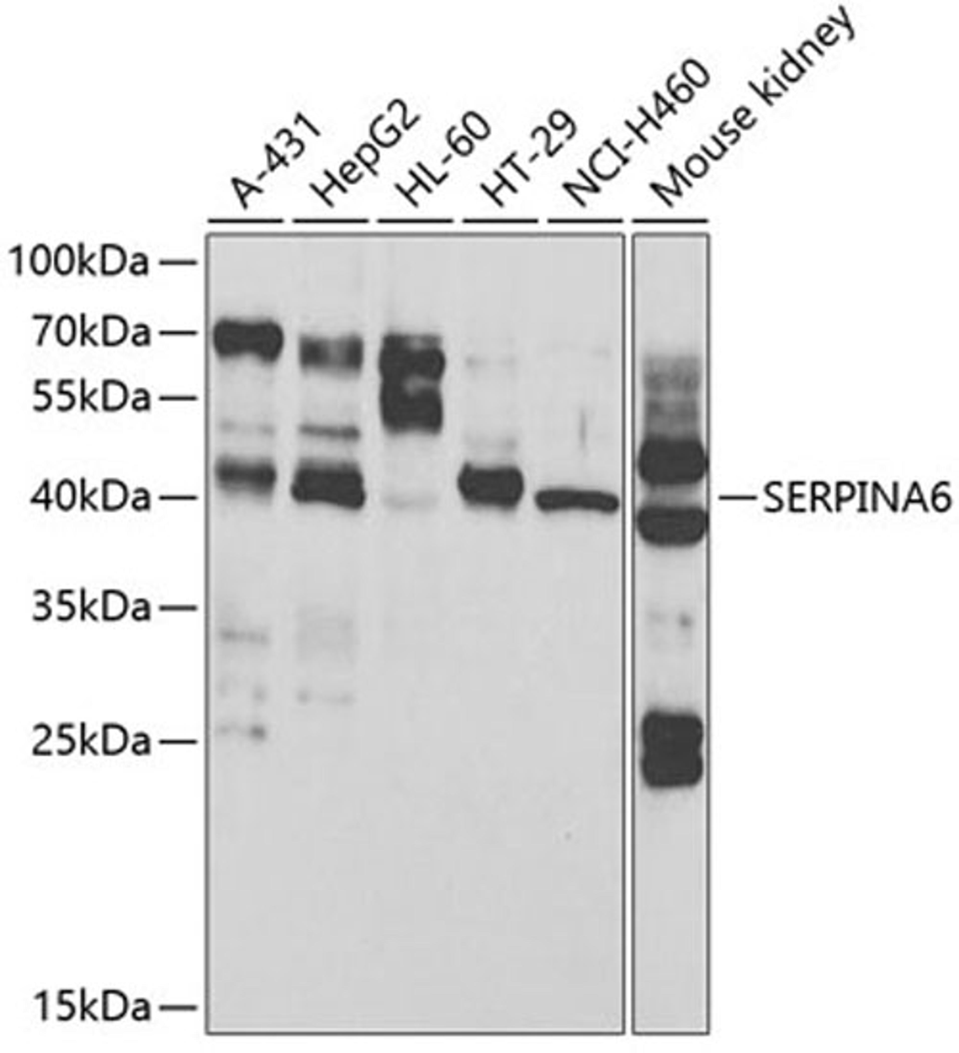 Western blot - SERPINA6 antibody (A13609)