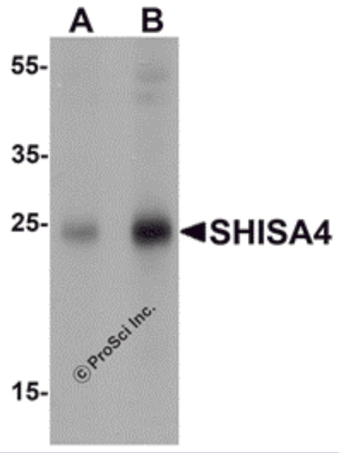 Western blot analysis of SHISA4 in human brain tissue lysate with SHISA4 antibody at (A) 1 and (B) 2 μg/mL.