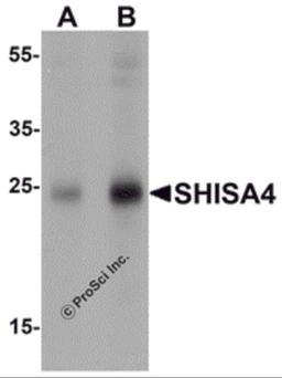 Western blot analysis of SHISA4 in human brain tissue lysate with SHISA4 antibody at (A) 1 and (B) 2 μg/mL.