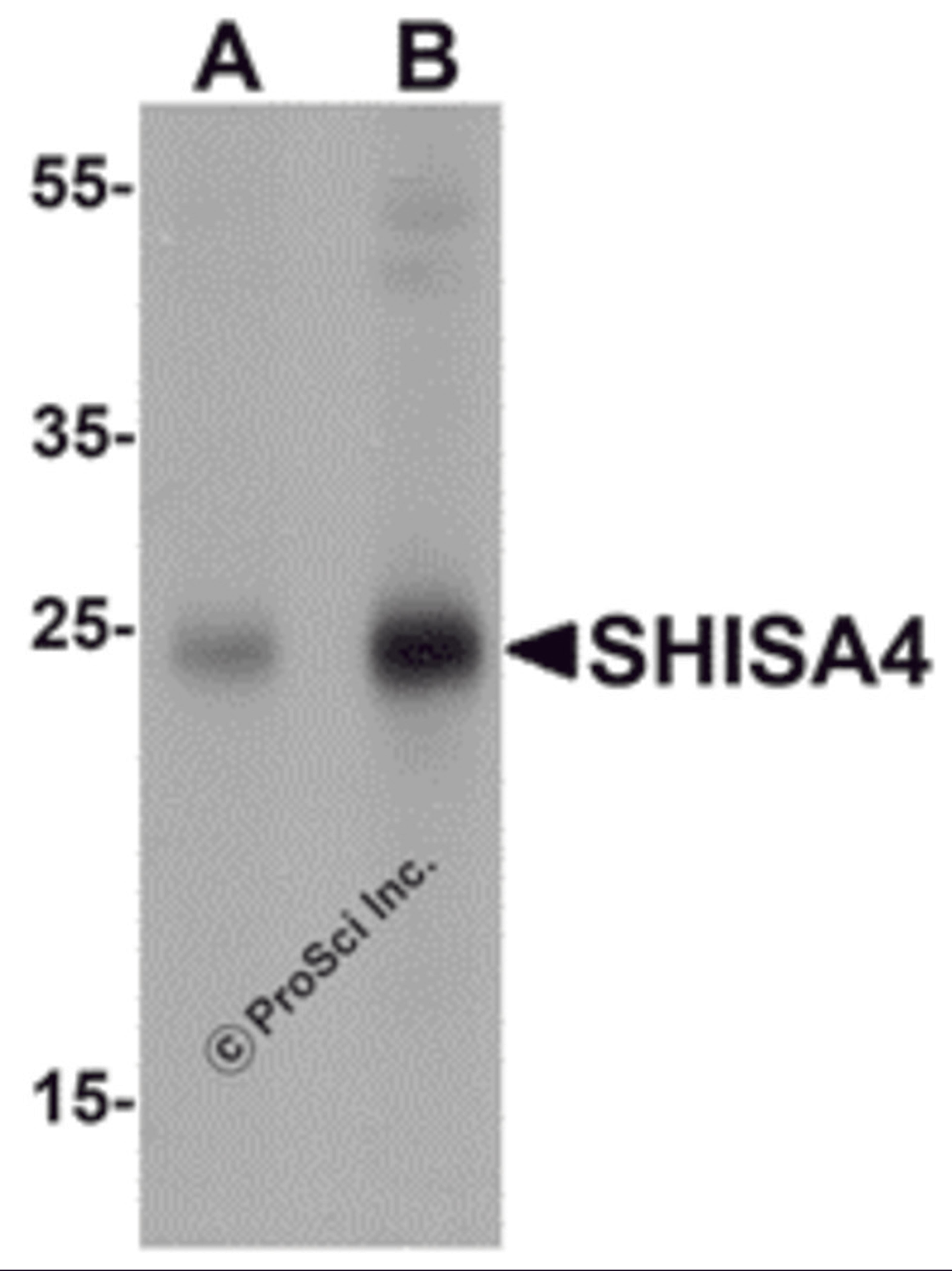 Western blot analysis of SHISA4 in human brain tissue lysate with SHISA4 antibody at (A) 1 and (B) 2 μg/mL.