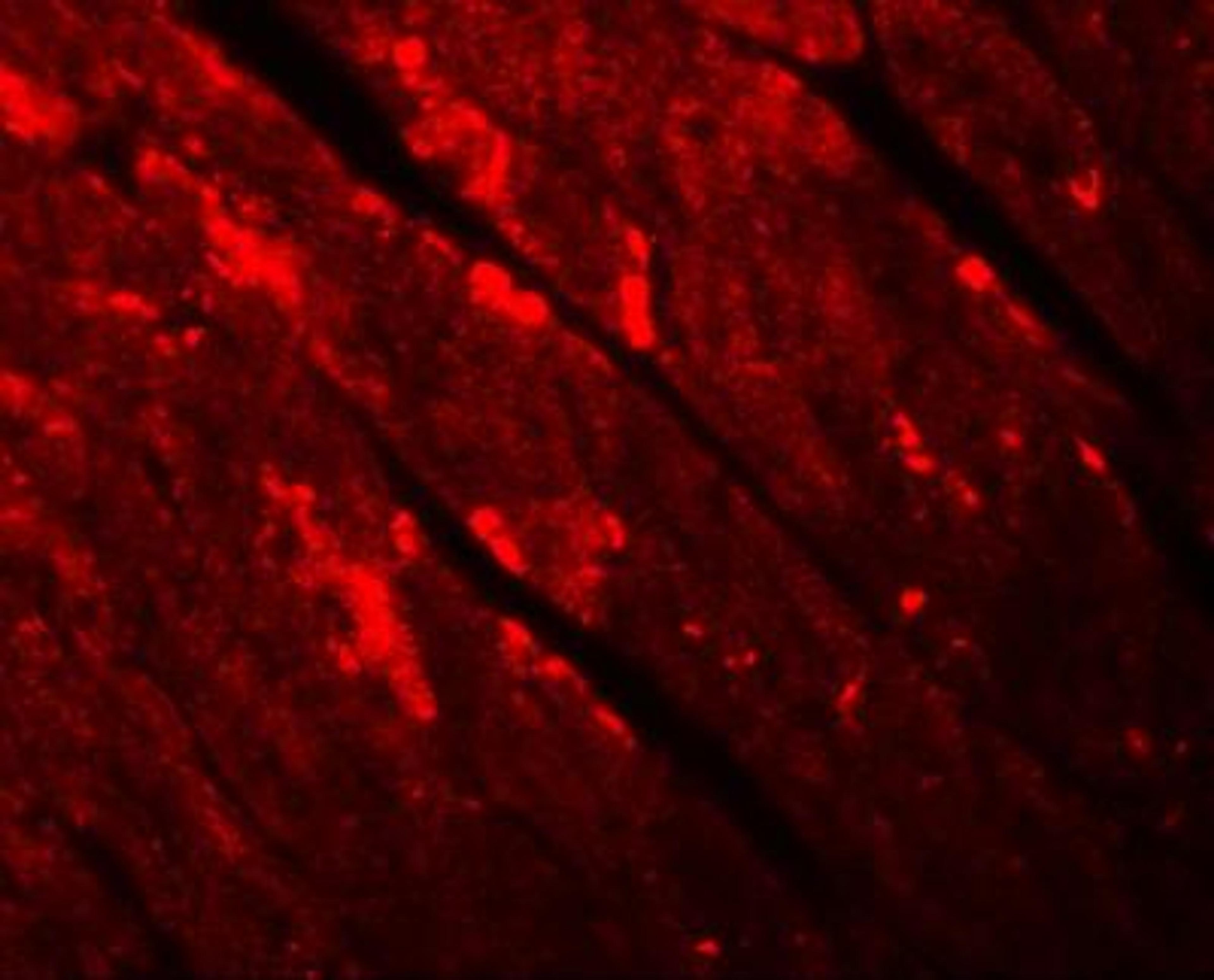 Immunocytochemistry/Immunofluorescence: TMEM34 Antibody [NBP1-77144] - Immunofluorescence of TMEM184C in mouse heart tissue with TMEM184B antibody at 20 ug/mL.