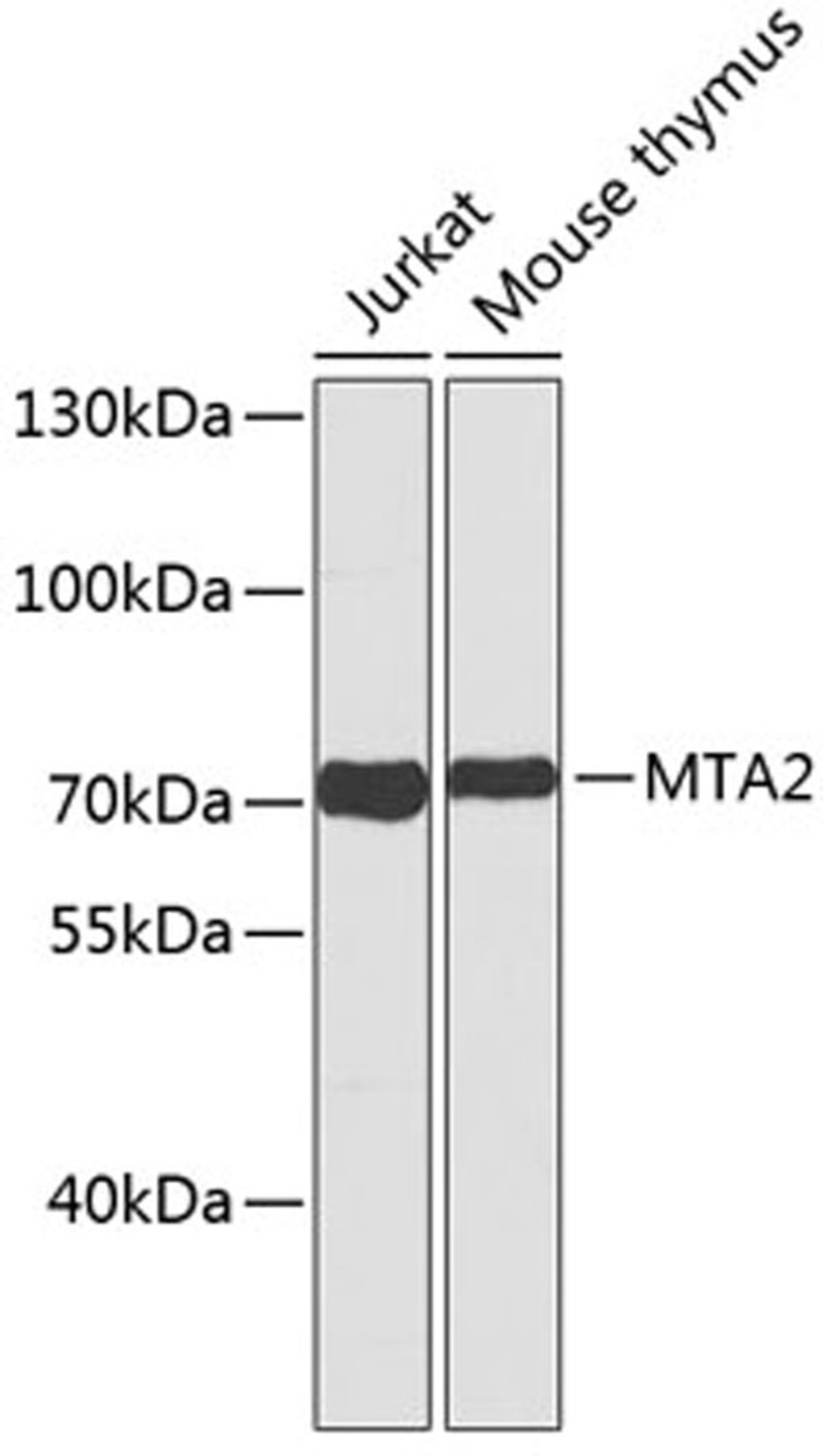 Western blot - MTA2 antibody (A2243)