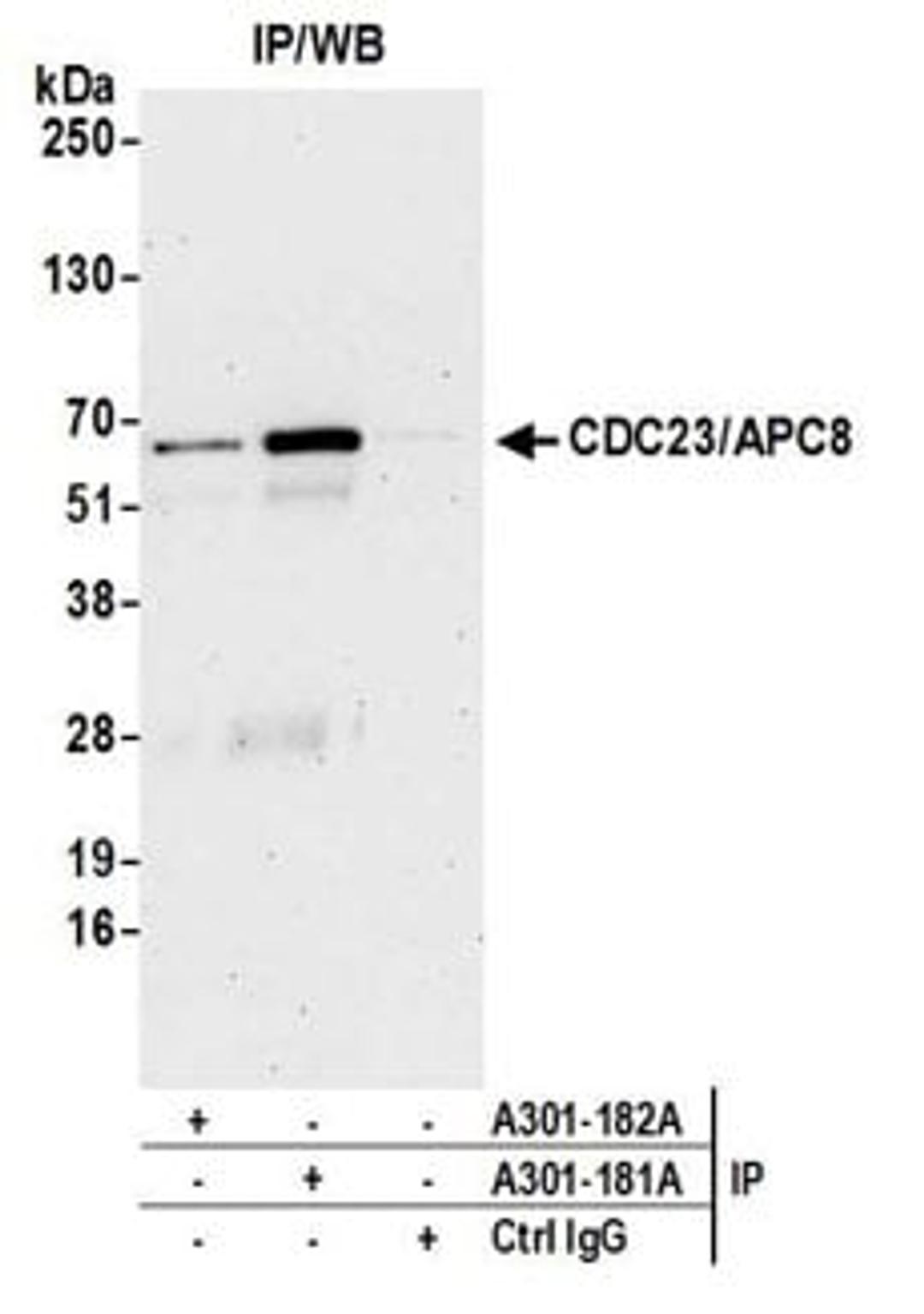 Detection of human CDC23/APC8 by western blot of immunoprecipitates.