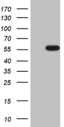 Western Blot: Casein Kinase 1 gamma Antibody (4D9) [NBP2-46384] - Analysis of HEK293T cells were transiently transfected with the pCMV6-ENTRY control (Left lane) or pCMV6-ENTRY Casein Kinase 1 gamma.